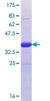 SDS-PAGE: Recombinant Human TET1 GST (N-Term) Protein [H00080312-Q01]