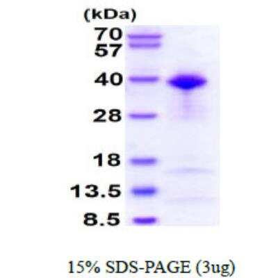 SDS-PAGE: Recombinant Human TFIIB His Protein [NBP1-30313]