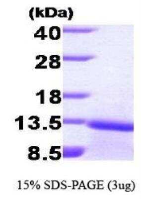 SDS-PAGE: Recombinant Human TGF-beta 1 Protein [NBP1-30225]