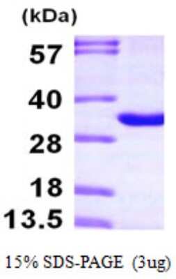 SDS-PAGE: Recombinant Human THYN1 His Protein [NBP1-49448]