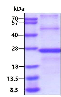 SDS-PAGE: Recombinant Human TIM-3 His Protein [NBP2-23118]