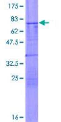 SDS-PAGE: Recombinant Human TSG101 GST (N-Term) Protein [H00007251-P01]