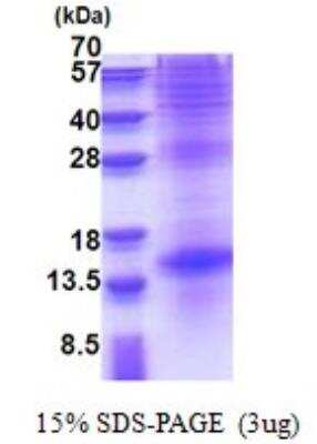 SDS-PAGE: Recombinant Human TSH beta His Protein [NBP2-22866]