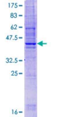 SDS-PAGE: Recombinant Human TSPAN9 GST (N-Term) Protein [H00010867-P01]