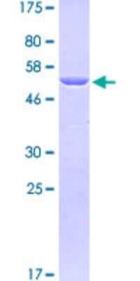 SDS-PAGE: Recombinant Human Talin1 GST (N-Term) Protein [H00007094-Q08]