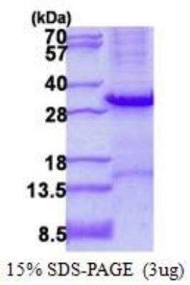 SDS-PAGE: Recombinant Human Tryptase alpha/beta 1 His Protein [NBP2-22894]