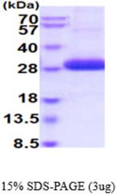 SDS-PAGE: Recombinant Human ULBP-2 His Protein [NBP2-59528]
