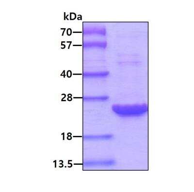 SDS-PAGE: Recombinant Human UROS His Protein [NBP1-72312]