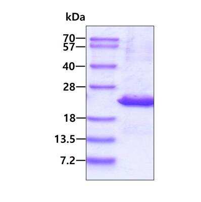 SDS-PAGE: Recombinant Human UXT His Protein [NBP2-22926]