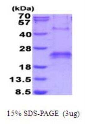 SDS-PAGE: Recombinant Human VEGF His Protein [NBP2-53040]