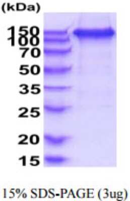 SDS-PAGE: Recombinant Human VEGF Receptor 2/3 hIgG-His Protein [NBP2-59909]