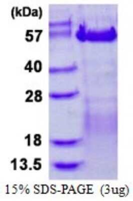 SDS-PAGE: Recombinant Human VRK3 His Protein [NBP1-98944]