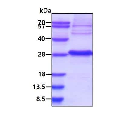 SDS-PAGE: Recombinant Human Von Hippel Lindau His Protein [NBC1-18497]