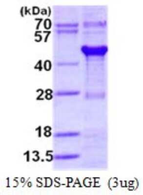 SDS-PAGE: Recombinant Human XAB1 His Protein [NBP1-98928]