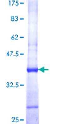 SDS-PAGE: Recombinant Human YF5 GST (N-Term) Protein [H00000755-Q01]