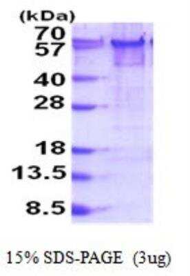 SDS-PAGE: Recombinant Human YY1 His Protein [NBP2-51866]