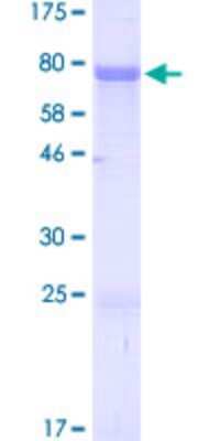 SDS-PAGE: Recombinant Human ZIC3 GST (N-Term) Protein [H00007547-P01]