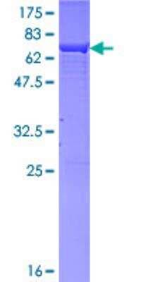 SDS-PAGE: Recombinant Human alcohol dehydrogenase 1B GST (N-Term) Protein [H00000125-P01]