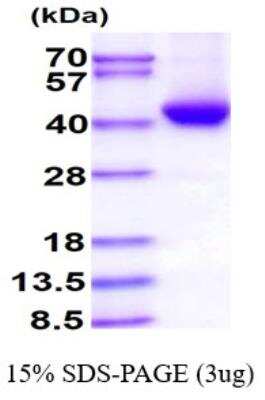 SDS-PAGE: Recombinant Human alcohol dehydrogenase 5 His Protein [NBP1-99053]