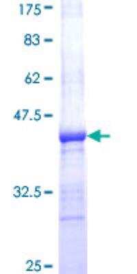 SDS-PAGE: Recombinant Human alpha Adaptin GST (N-Term) Protein [H00000160-Q01]