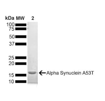 SDS-PAGE: Recombinant Human alpha-Synuclein Active, Monomer, (Type 1), A53T Mutant Protein [NBP3-14766]