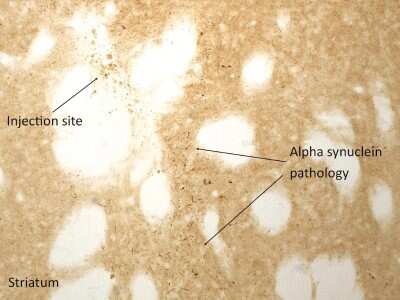 Immunohistochemistry: Recombinant Human alpha-Synuclein Active, Pre-formed Fibrils, (Type 1) Protein [NBP2-54789]