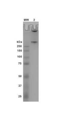 SDS-PAGE: Recombinant Human alpha-Synuclein Oligomers, (Dopamine HCL Stabilized) Protein [NBP3-14771]