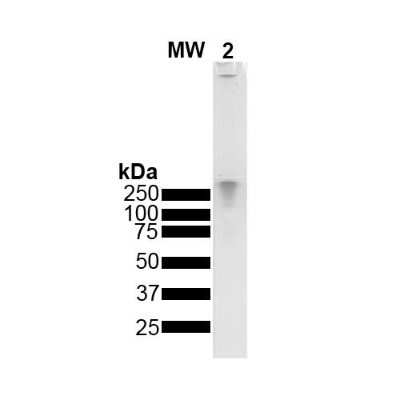 SDS-PAGE: Recombinant Human alpha-Synuclein Oligomers, (Dopamine HCL Stabilized) Protein [NBP3-14772]