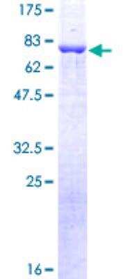 SDS-PAGE: Recombinant Human beta-Arrestin 2 GST (N-Term) Protein [H00000409-P01]
