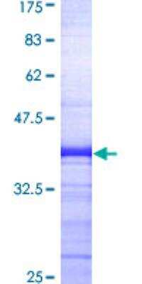 SDS-PAGE: Recombinant Human beta-Arrestin 2 GST (N-Term) Protein [H00000409-Q01]