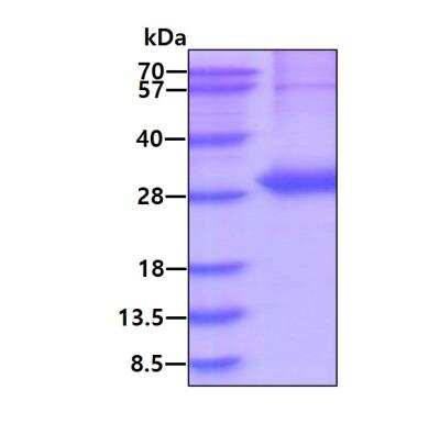 SDS-PAGE: Recombinant Human beta Casein His Protein [NBP1-99089]
