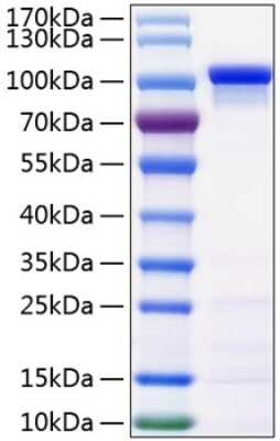 SDS-PAGE: Recombinant Human beta-Catenin His (C-Term) Protein [NBP3-18198]