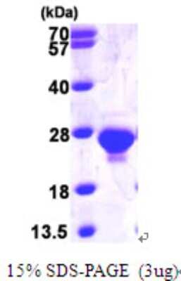 SDS-PAGE: Recombinant Human dUTPase His Protein [NBP1-48598]