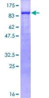 SDS-PAGE: Recombinant Human gamma Catenin GST (N-Term) Protein [H00003728-P01]