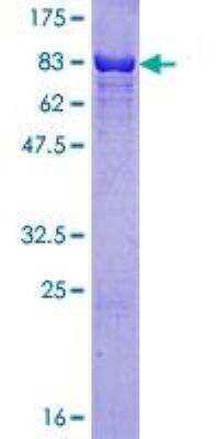 SDS-PAGE: Recombinant Human hHR23b GST (N-Term) Protein [H00005887-P01]