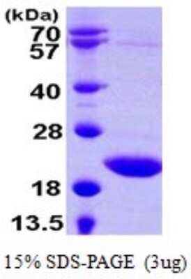 SDS-PAGE: Recombinant Human sen15 His Protein [NBP1-72318]