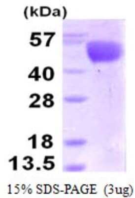 Western Blot: Recombinant Influenza A H3N2 Hemagglutinin (A/Perth/16/2009) His Protein [NBP1-99044]