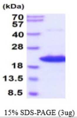 SDS-PAGE: Recombinant Mouse AG-2/AGR2 His Protein [NBP2-59537]