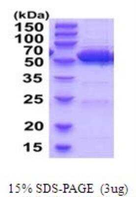 SDS-PAGE: Recombinant Mouse ALDH2 His Protein [NBP2-52106]