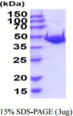 SDS-PAGE: Recombinant Mouse Adenosylhomocysteinase/AHCY His Protein [NBP2-59889]