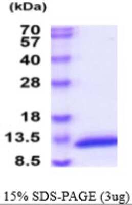 SDS-PAGE: Recombinant Mouse CAMK2N1 His Protein [NBP2-59577]