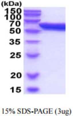 SDS-PAGE: Recombinant Mouse ERp57/PDIA3 His Protein [NBP2-59883]