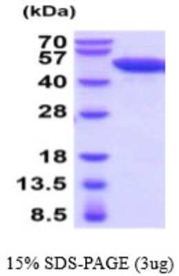 SDS-PAGE: Recombinant Mouse Enolase 2/Neuron-specific Enolase His Protein [NBP2-59536]