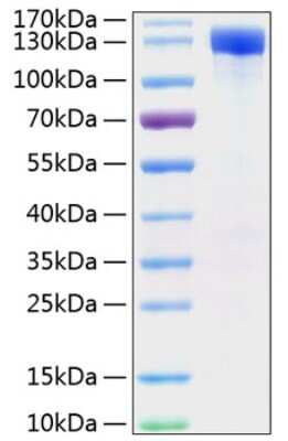 SDS-PAGE: Recombinant Mouse ErbB2/Her2 Fc His (C-Term) Protein [NBP3-18207]