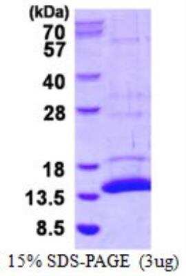 SDS-PAGE: Recombinant Mouse S100A7A His Protein [NBP2-23450]