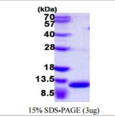SDS-PAGE: Recombinant Mouse S100A8 His Protein [NBP1-72331]