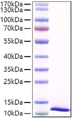 SDS-PAGE: Recombinant Mouse SPINK4 His (C-Term) Protein [NBP3-18208]