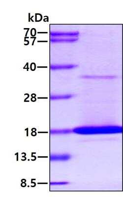 SDS-PAGE: Recombinant Mouse TRANCE/TNFSF11/RANK L Protein [NBP2-77509]