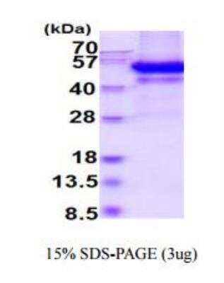 SDS-PAGE: Recombinant Mouse Testican 3/SPOCK3 His Protein [NBP2-50571]