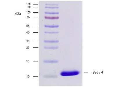 SDS-PAGE: Recombinant Plant Betula verrucosa 4.0101 Strep (N-Term) Protein [NBP3-06723]